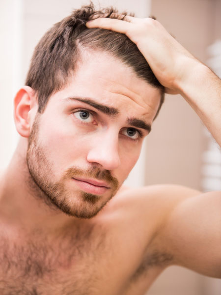 Young man with receeding hairline